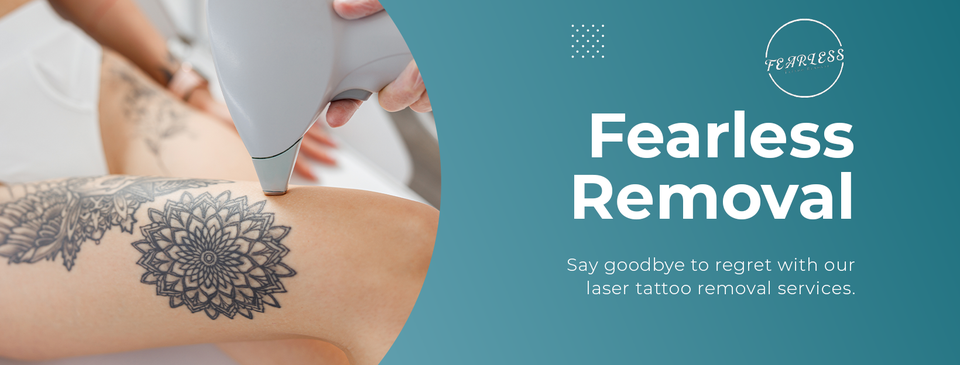 Fearless Tattoo Removal